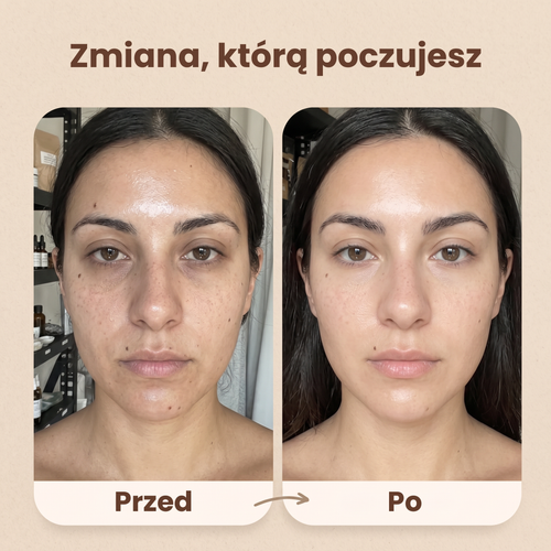 Zenvy™ Szczotka Liftingująca